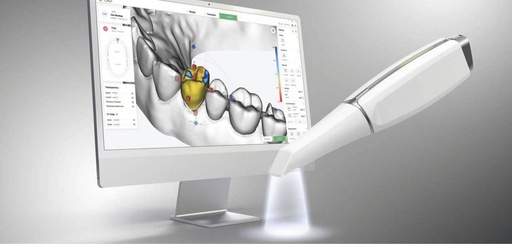 [LS-100 STOCK] Lilivis SCAN LS-100 (Stock)